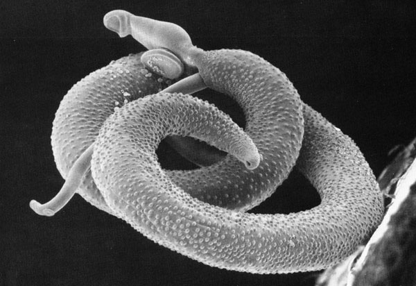 Schistosoma mansoni parasite that causes schistosomiasis